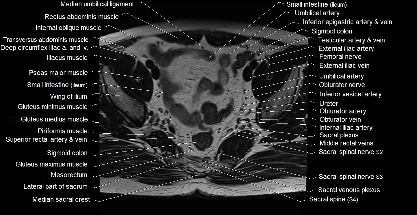 Male pelvis axial cross sectional anatomy image 15.webp